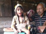 9 Tahun di Tempat Tidur, Bocah Difabel di Manggarai Timur Butuh Bantuan, Ayo Donasi